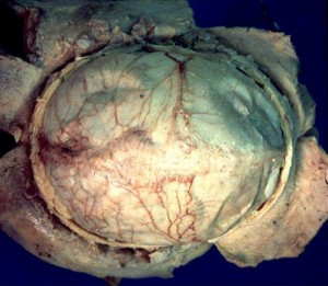 Human_brain_dura_mater